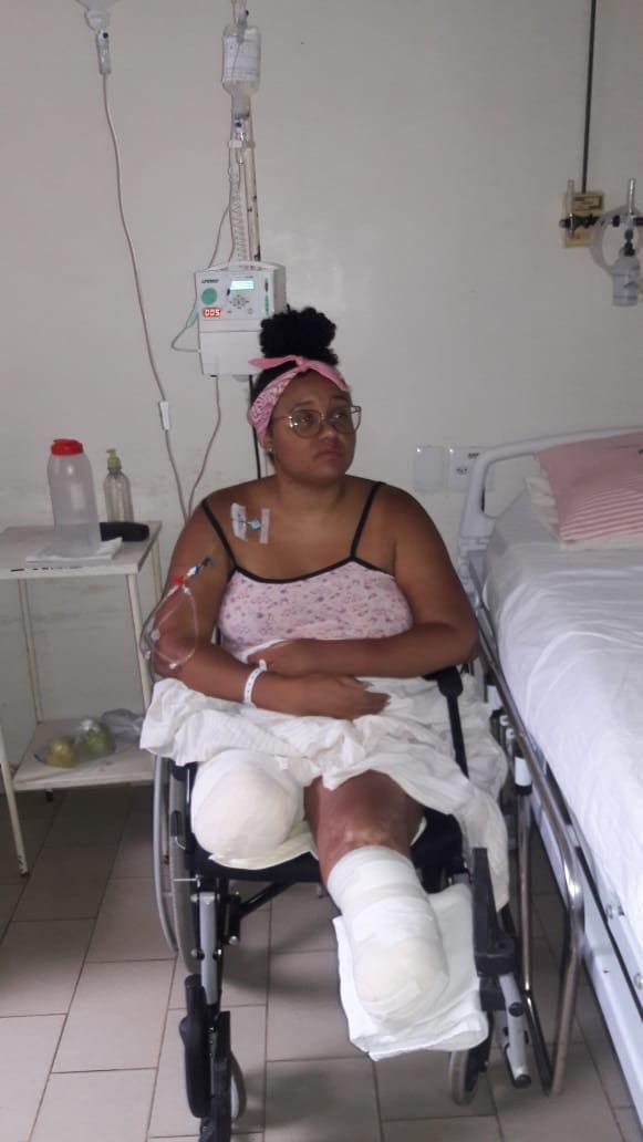 Doença acabou comprometendo os tendões e os joelhos de Urânia Santos Zacarias, de 29 anos, e fez com que a betinense tivesse que amputar parte das duas pernas